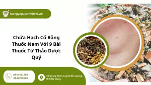 Chữa hạch cổ bằng thuốc nam